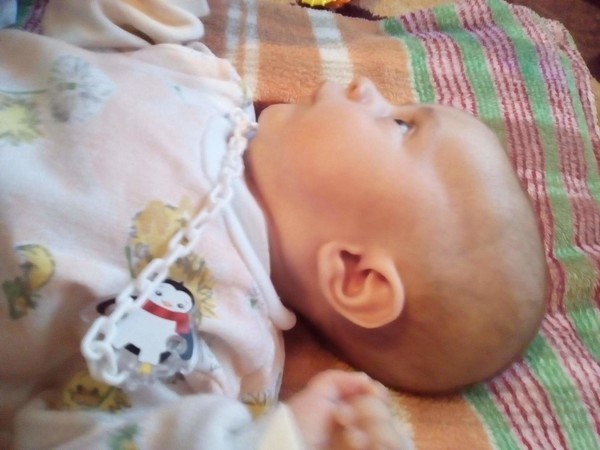 Малышу 3 месяца форум. Долихоцефалическая форма головы у ребенка. Вытянутая форма головы у ребенка. Форма головы у новорожденного ребенка.
